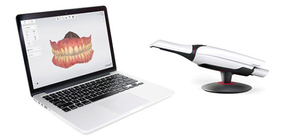 trios-digital-scanners